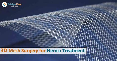 dr richard miller hernia mesh removal|U.S. Mesh Doctors .